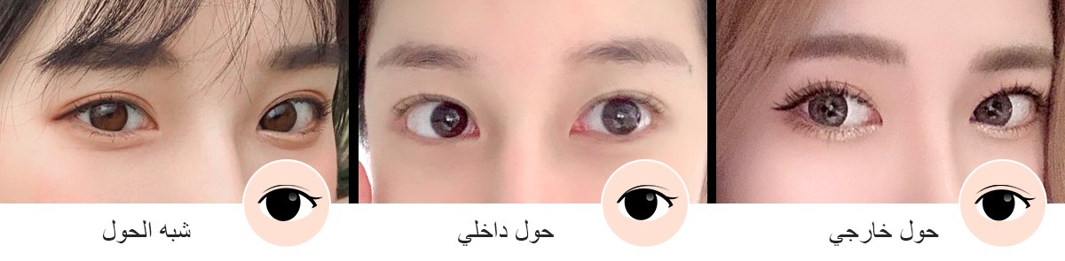 eyes04_img01