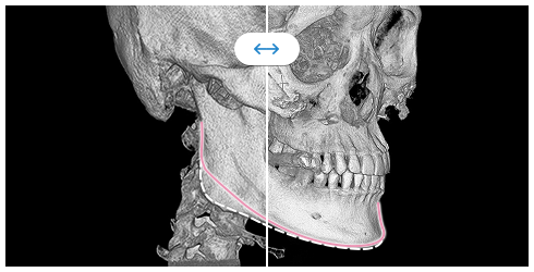 face04_img01